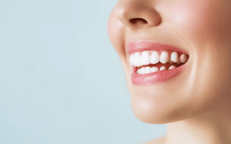vital things to know about teeth whitening