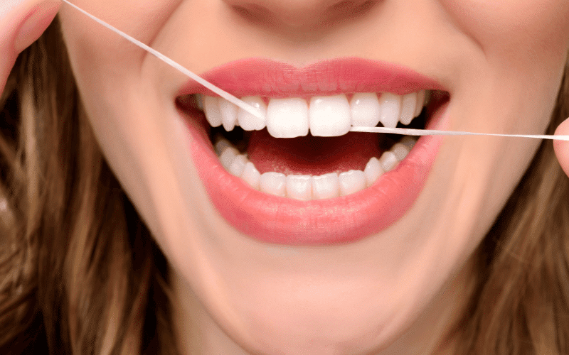 Featured image for “Why Flossing Between Porcelain Veneers Is Important?”