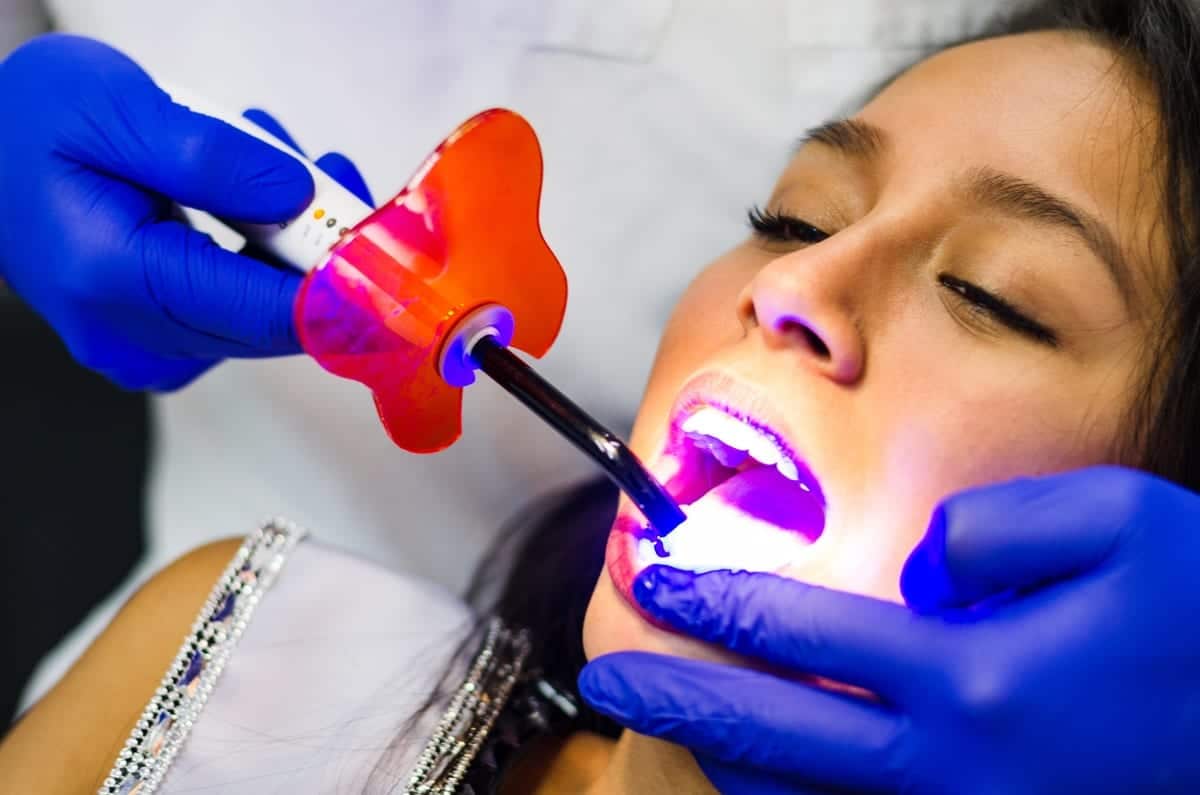 Featured image for “Teeth Whitening Timeline in Glendale, AZ | Singh Smile Care”