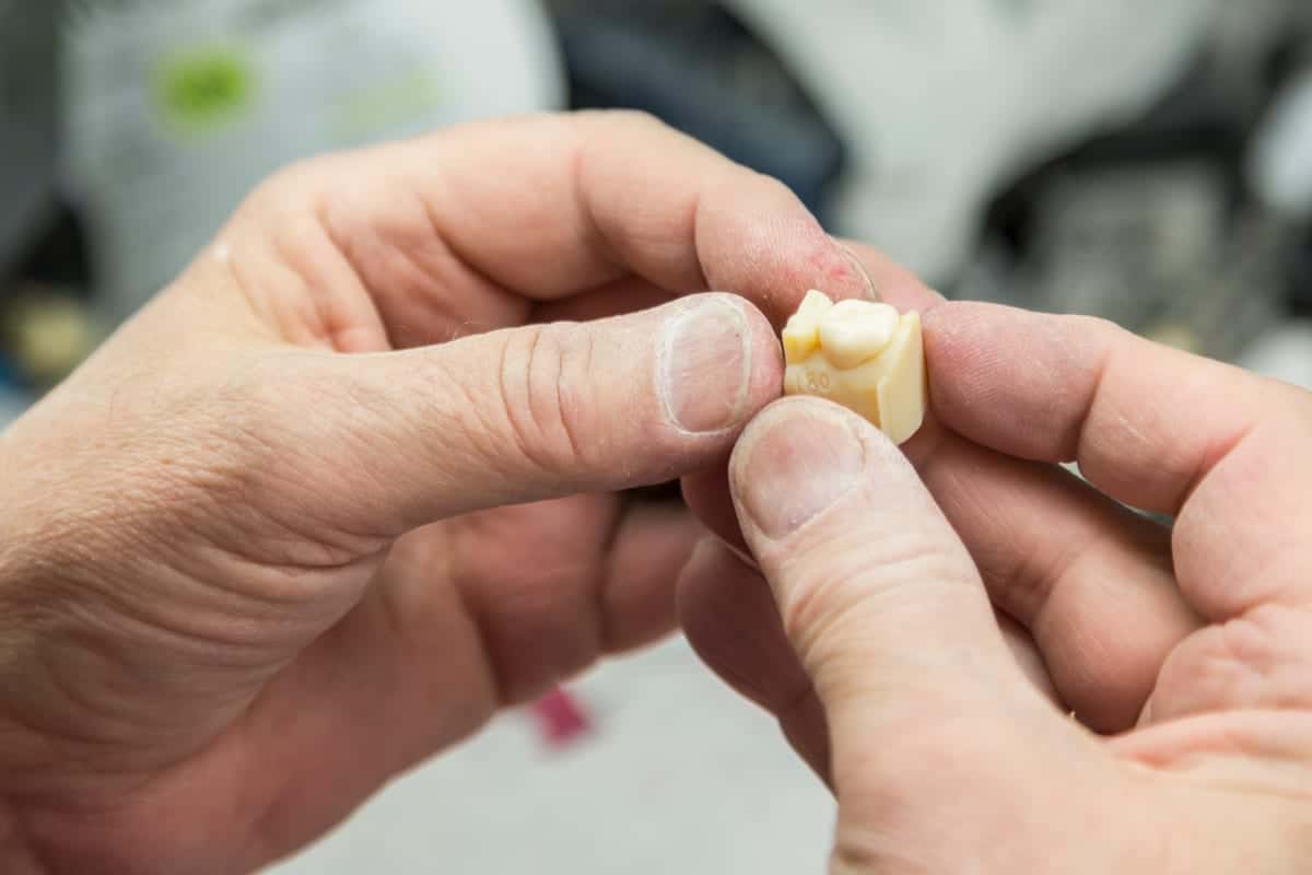 Dental Crowns in Peoria